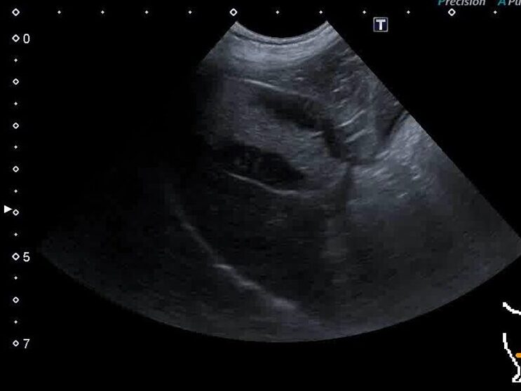 兵庫みなと動物病院の「胆嚢の病気が「腸」から変わる可能性 ― 糞便微生物移植(FMT)の症例より」画像